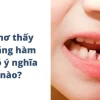Giải mã giấc mơ thấy rụng răng: Điềm lành hay dữ?