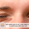 Giật mắt phải ở nữ có phải điềm báo gì? Giải mã dưới góc độ y học và tâm linh