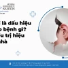 Ù Tai Trái Điềm Gì Giải Mã Theo Giờ Và Ý Nghĩa Sức Khỏe Năm 2026