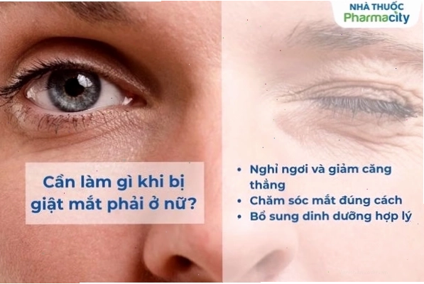 Các biện pháp khắc phục khi bị giật mắt phải nữ