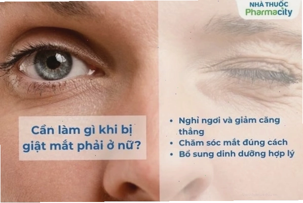 Cách khắc phục tình trạng nháy mắt phải ở nữ giới