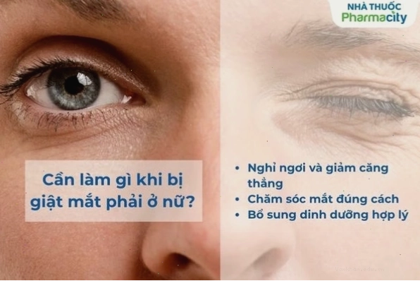 Cần làm gì khi bị giật mắt phải ở nữ?