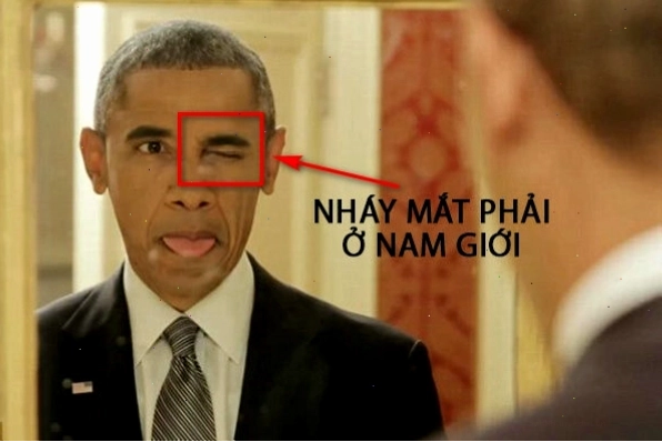 Hình ảnh minh họa nam giới bị giật mắt phải