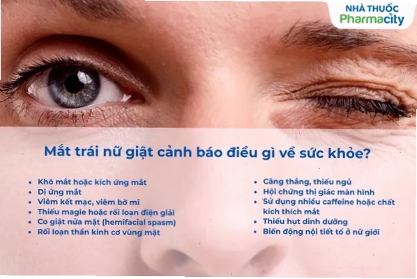 Mắt trái nữ giật cảnh báo bệnh gì