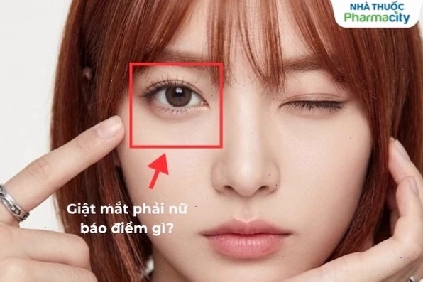 Nguyên nhân nháy mắt phải ở nữ do căng thẳng và mệt mỏi