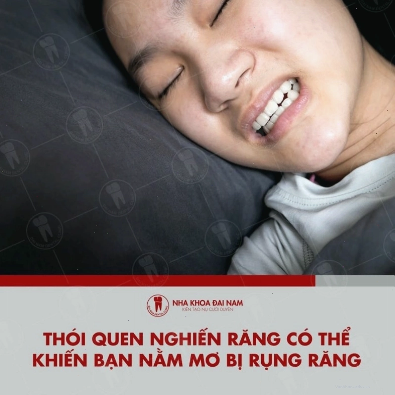 Thói quen nghiến răng và ảnh hưởng đến giấc mơ rụng răng