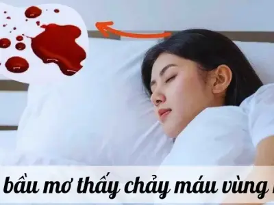 Bà bầu mơ thấy chảy máu vùng kín là điềm báo gì? Nên làm gì?