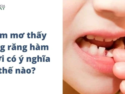 Giải mã giấc mơ thấy rụng răng: Điềm lành hay dữ?