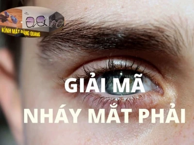 Mắt phải giật ở nữ là điềm gì? Hên hay xui, hay dấu hiệu bệnh lý?