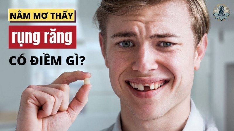 Giải mã giấc mơ rụng 4 cái răng theo quan niệm dân gian