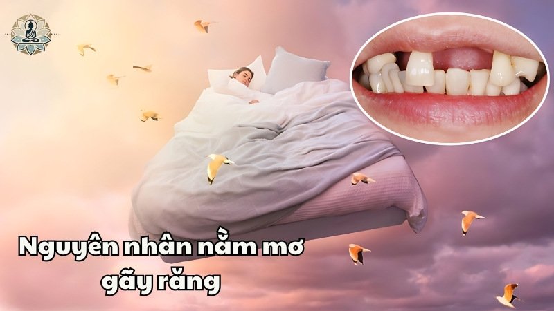 Nguyên nhân dẫn đến giấc mơ gãy răng